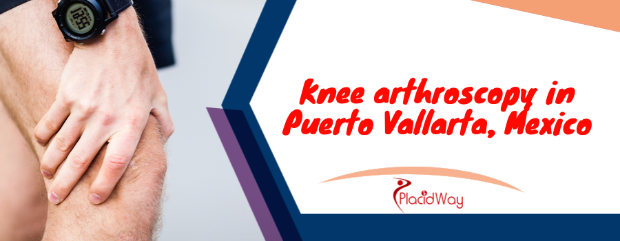 Knee arthroscopy in Puerto Vallarta, Mexico